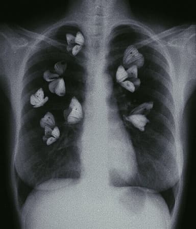 Cancer Treatments